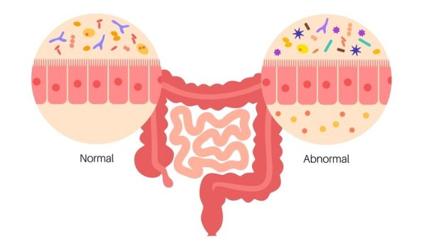 Gut,Brain,Connection,,Dysbiosis,And,Microbiome.,Surface,Area,Of,Intestinal Gut,Brain,Connection,,Dysbiosis,And,Microbiome.,Surface,Area,Of,Intestinal