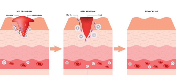 Wound,Healing,Science,Design,Vector,Illustration,Diagram Wound,Healing,Science,Design,Vector,Illustration,Diagram