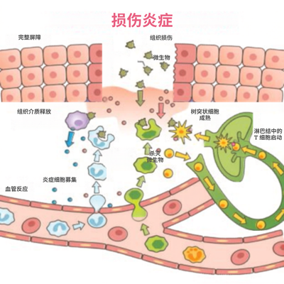 损伤炎症