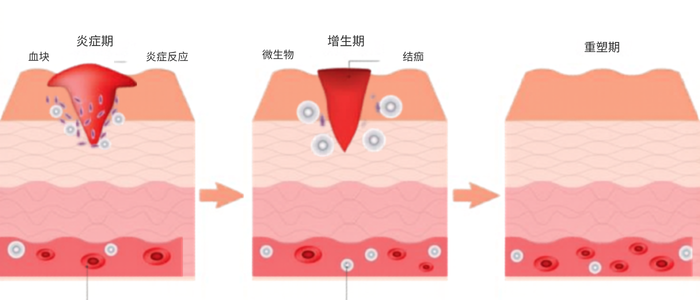炎症期