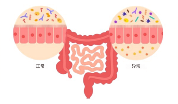 肠道微生物群与免疫调节